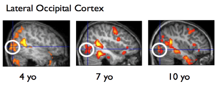 Lateral Occipital Cortex: three images compare brain development at ages four, seven, and ten years.