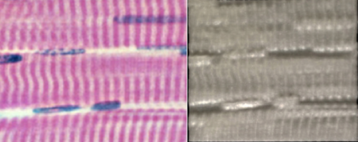 Compares accuracy of 3D print with image from a microscope slide of skeletal muscle from which the 3D print was made.