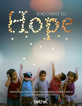 The cover of Exposed to Hope